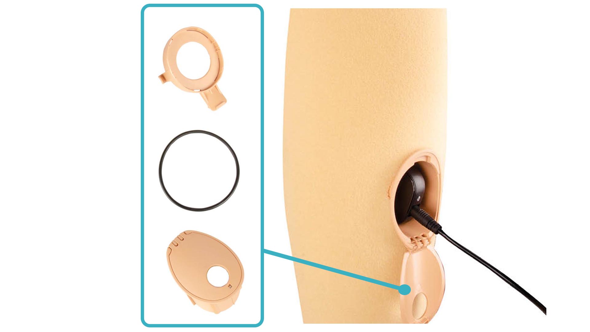 義足コンピューター制御膝継手 Kenevo 4X634 フォームカバー チャージングセット