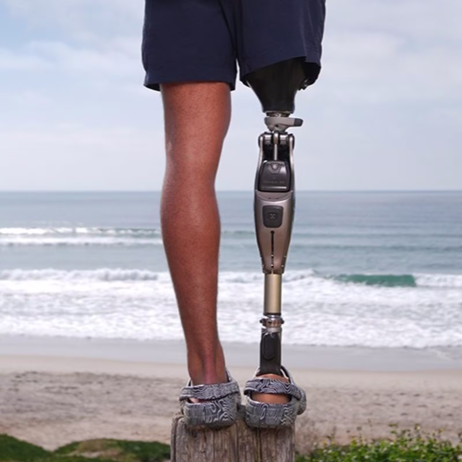 Das Bild zeigt den Unterkörper einer amputierten Person. Am rechten Bein trägt die Person das mechatronische Prothesenkniegelenk Genium X4 von Ottobock. Im Hintergrund sind Strand und Meer zu sehen.