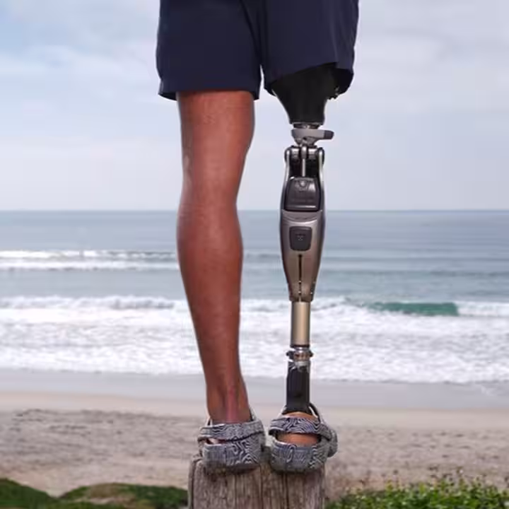 Das Bild zeigt den Unterkörper einer amputierten Person. Am rechten Bein trägt die Person das mechatronische Prothesenkniegelenk Genium X4 von Ottobock. Im Hintergrund sind Strand und Meer zu sehen.