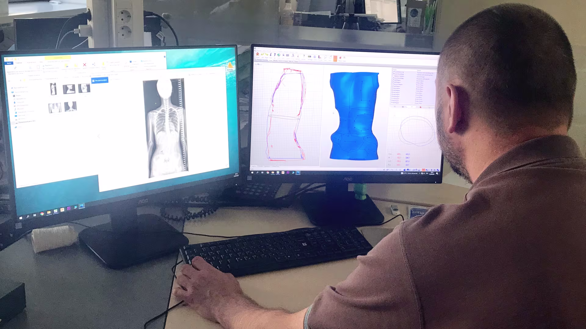 Моделирование функционально-корригирующего корсета по методике Шено