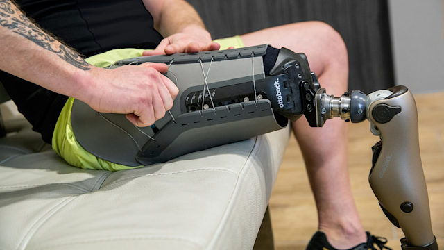 Back to mobility | Prosthetic fitting