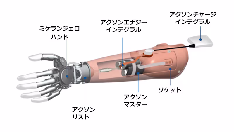 筋電義手 ミケランジェロMichelangelo 構造と仕組み