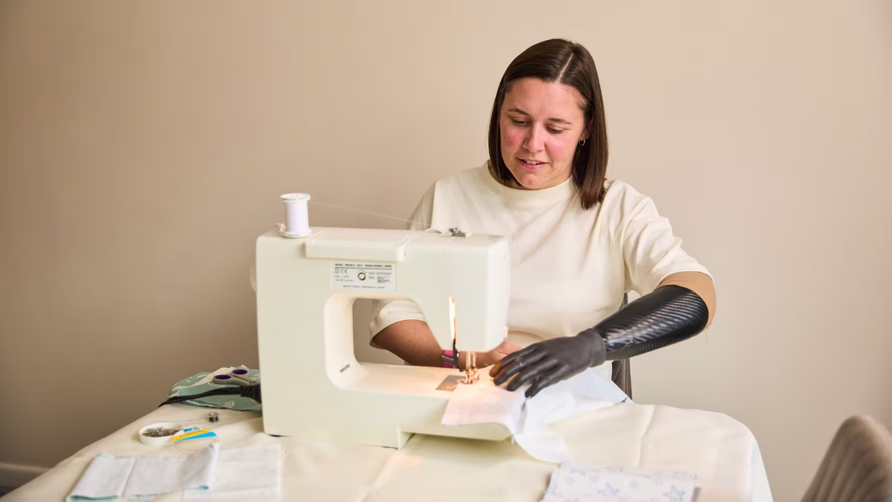Ashleigh bebionic prosthetic hand