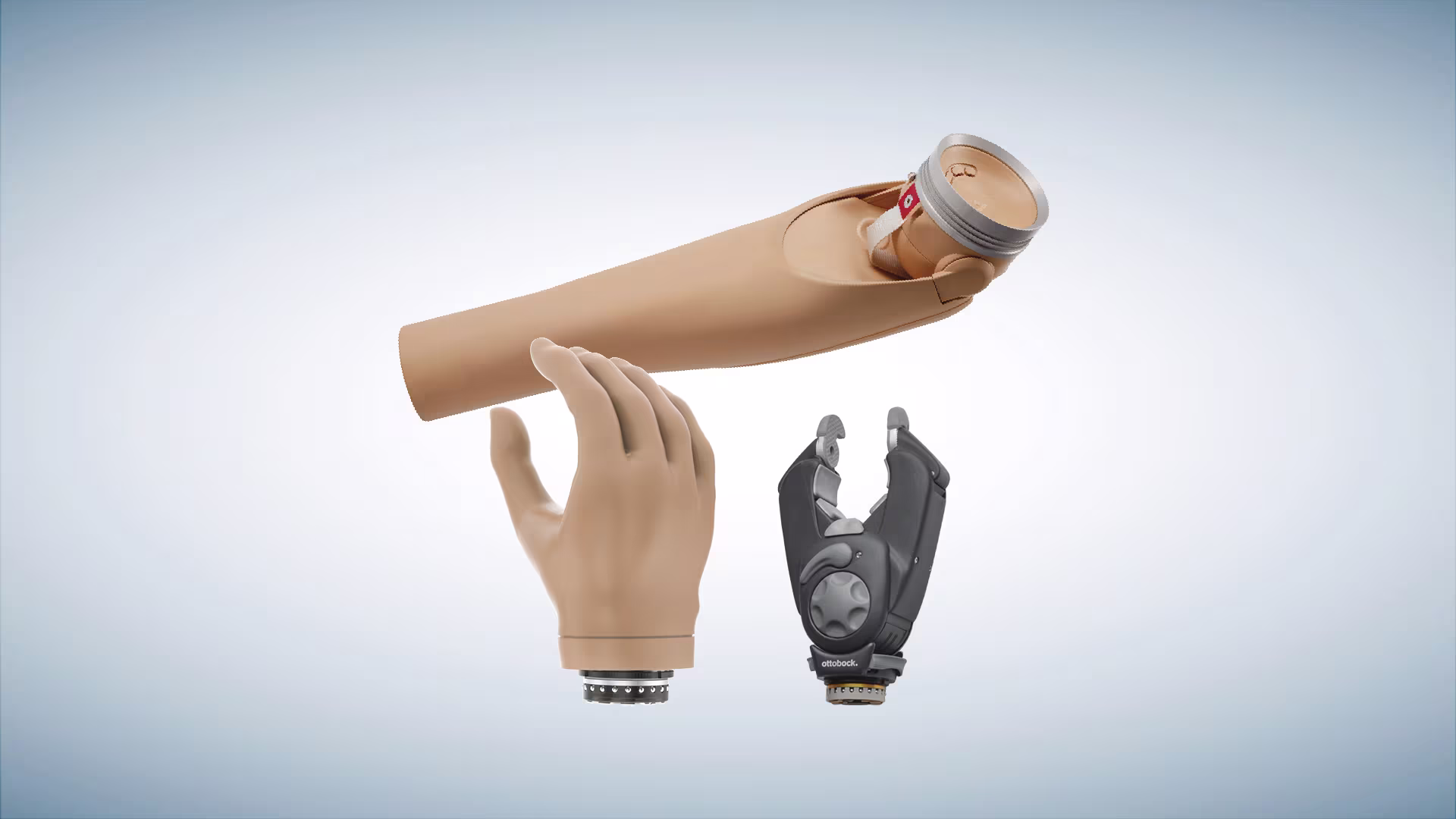 Ottobock DynamicArm with Speedhand and Greifer prosthetic components.