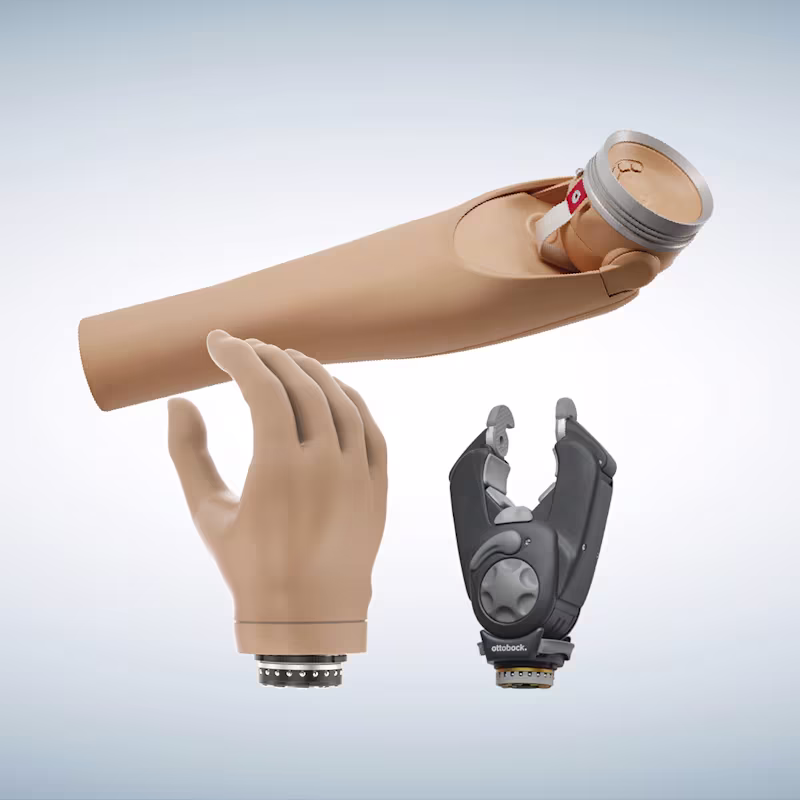Ottobock DynamicArm with Speedhand and Greifer prosthetic components.