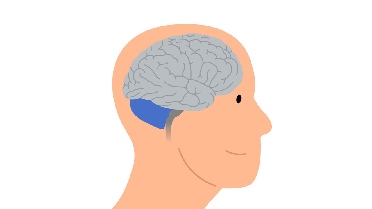 Graphic of a human head and brain in which the areas of the brain affected by Ataxia are highlighted in blue