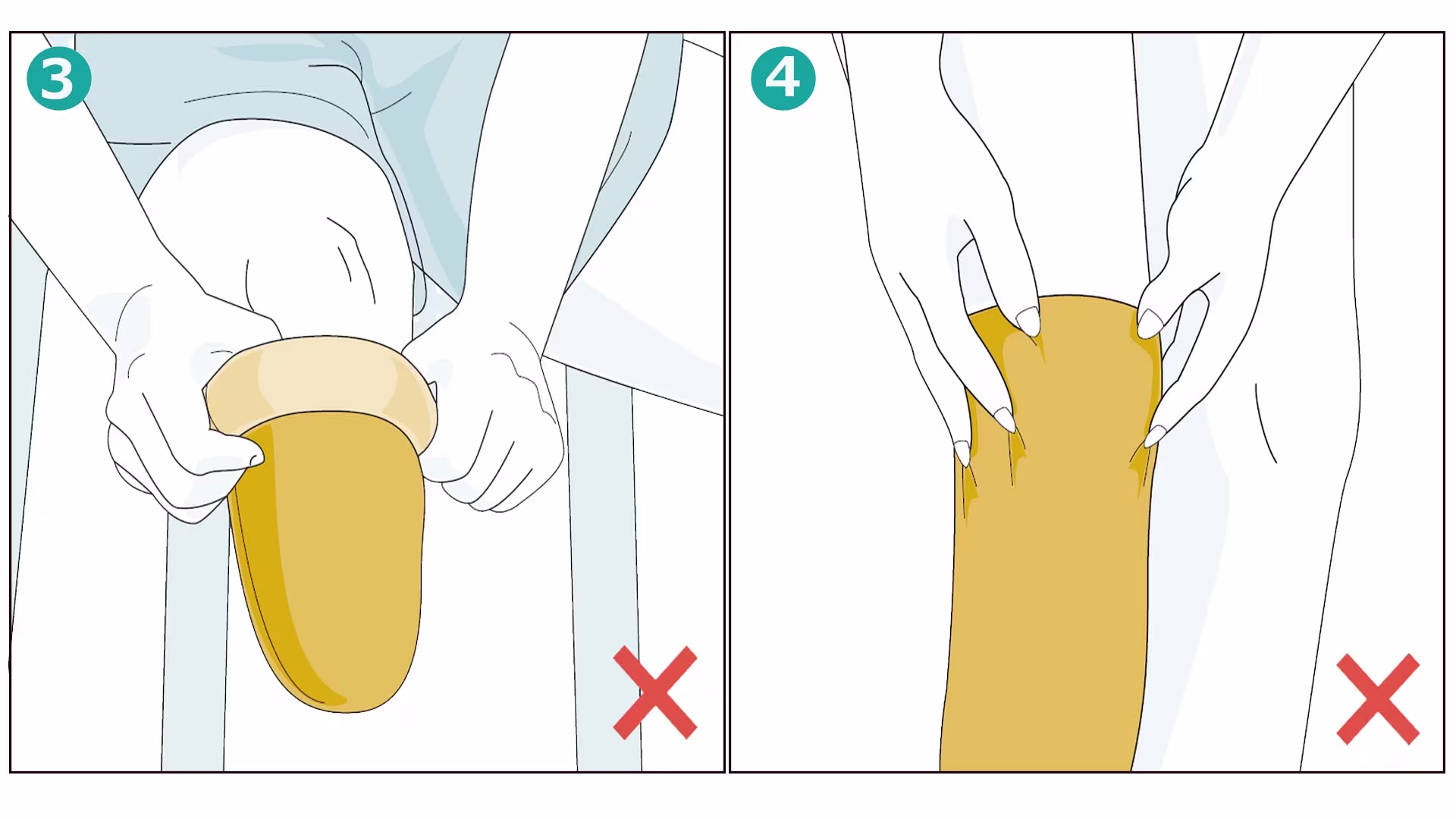 義足ライナー 誤った装着方法 爪を立てない 空気を抜く 丸めない 外装布を滑らせる
