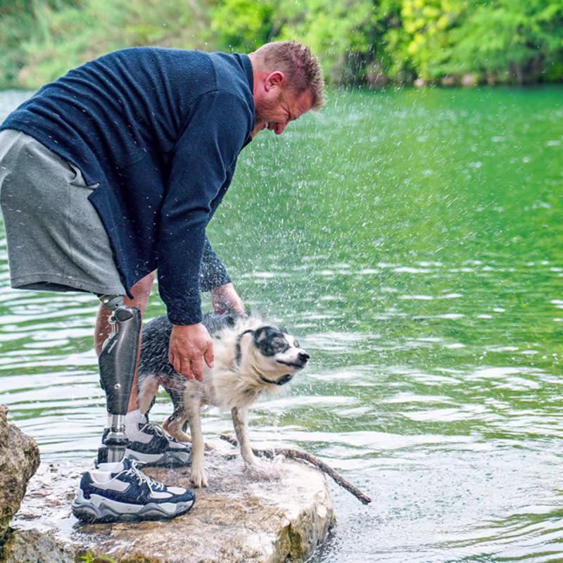 A C-Leg user is standing beside a river with his dog shaking water over his prosthetic knee