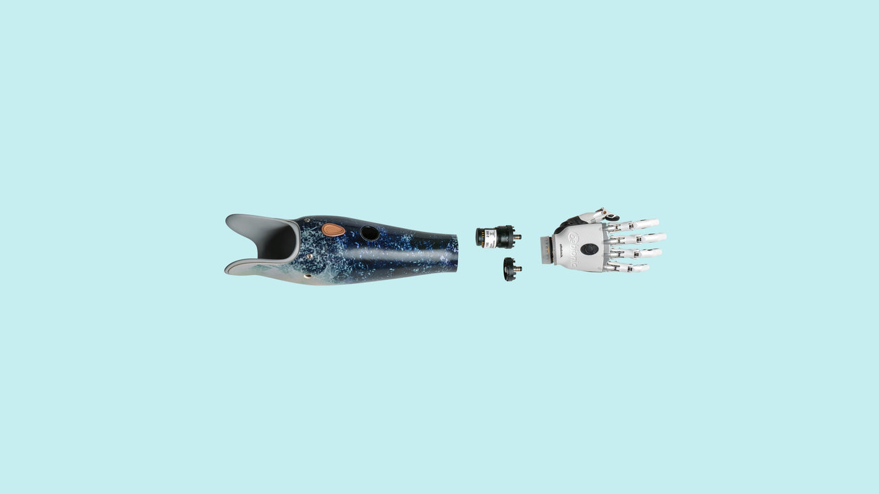Hier werden die Myo Plus und bebionic Hand von Ottobock für einen Armprothesenträger gezeigt.