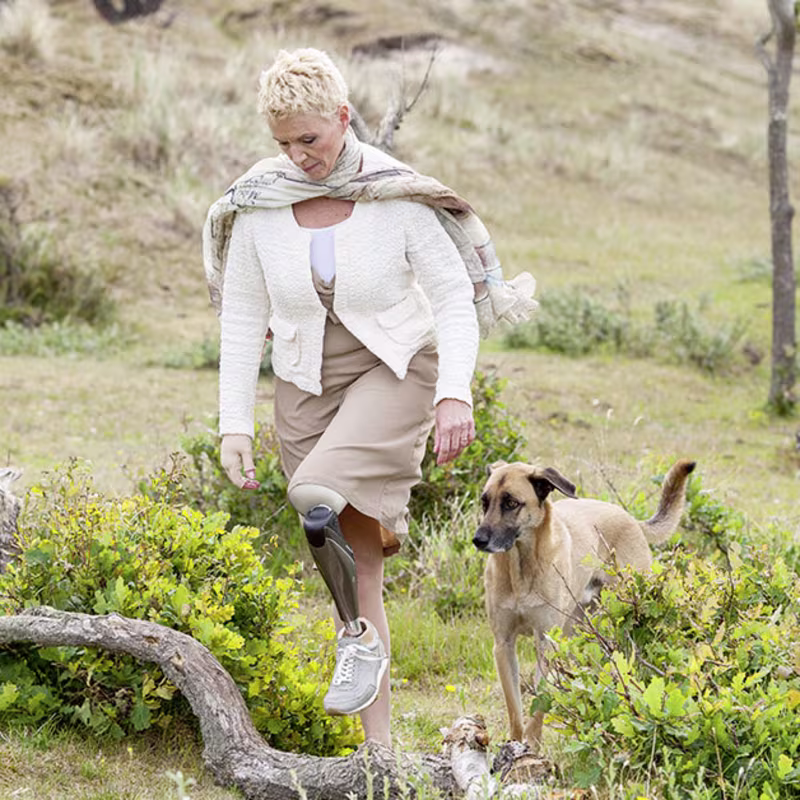 FirstSpiritExport,OBISCM-1557,web_site,prosthetics_2,lower_limb_1,mpk_know_the_difference,opg