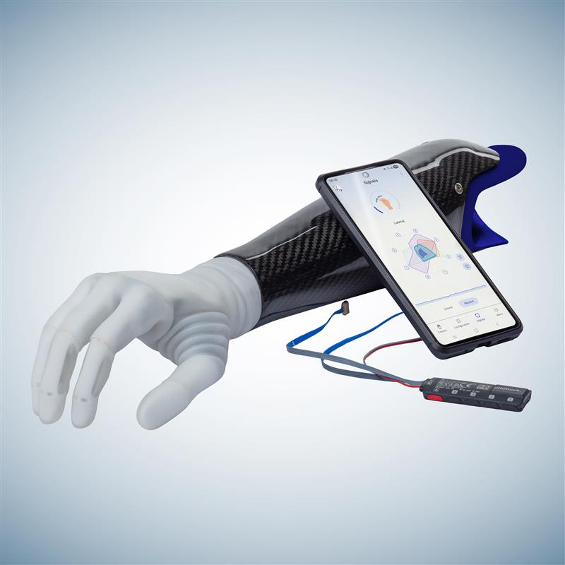 The michelangelo prosthetic hand attached to a socket, placed next to a smartphone displaying connectgrip and the myosmart plus control.