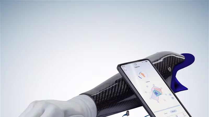The michelangelo prosthetic hand attached to a socket, placed next to a smartphone displaying connectgrip and the myosmart plus control.