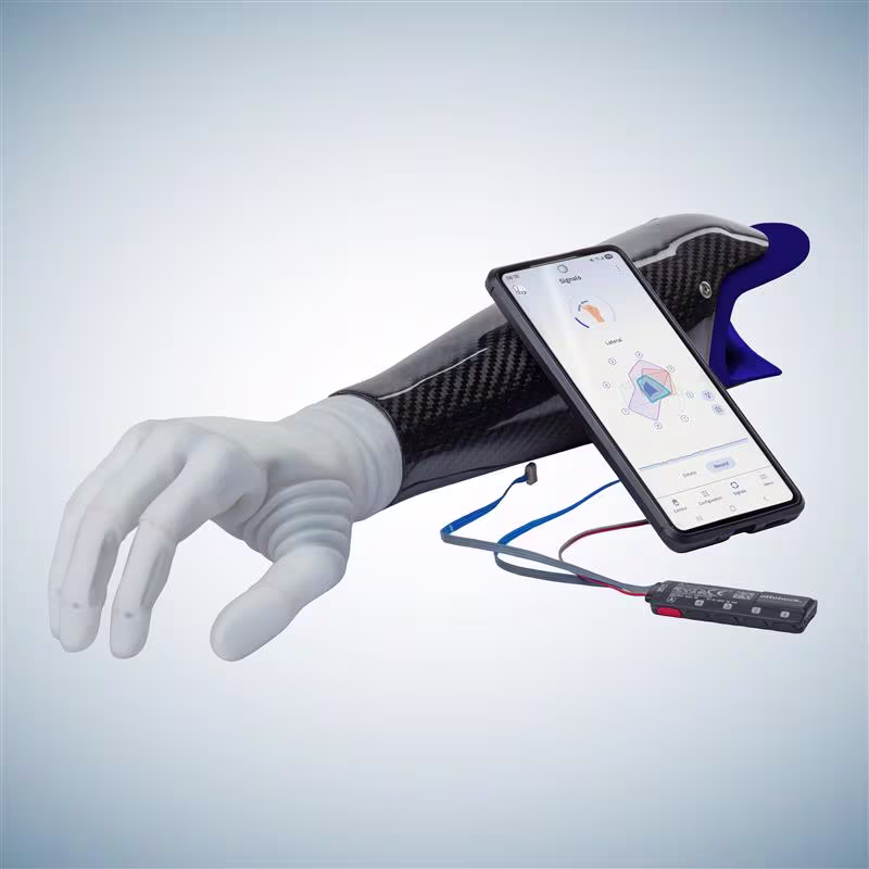 The michelangelo prosthetic hand attached to a socket, placed next to a smartphone displaying connectgrip and the myosmart plus control.