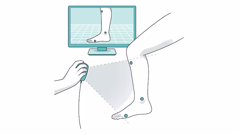 FirstSpiritExport,OBISCM-1557,web_site,prosthetics_2,ifab_1,ifab_images