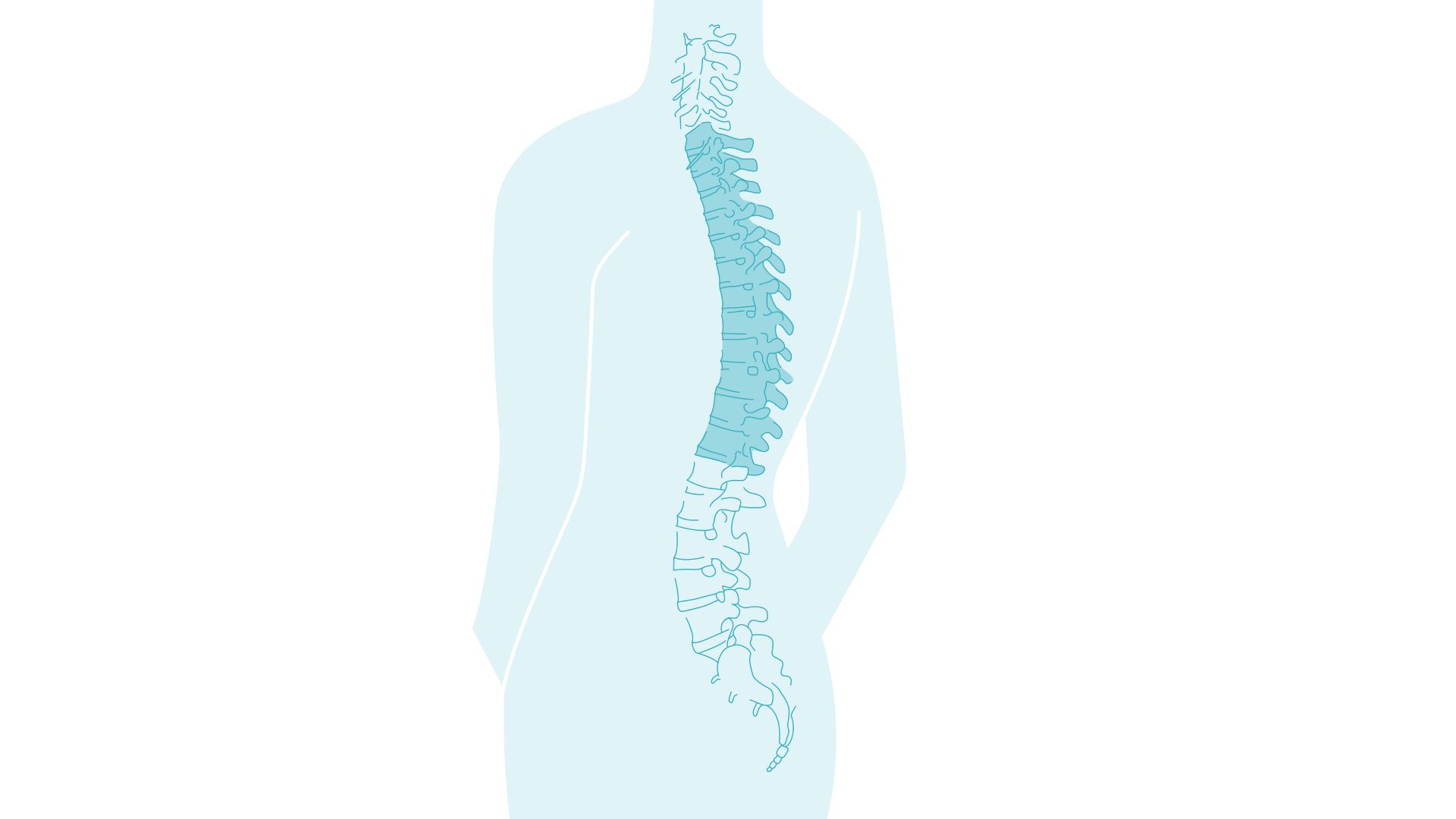 Spine marked in thoracic area (upper or mid-back).