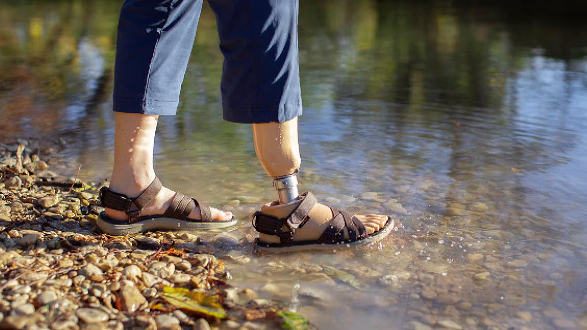 義足足部1C53タレオLP カーボン構造 防水仕様