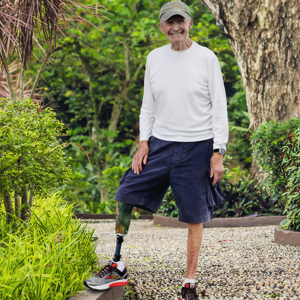 An elderly man posing in his Kintrol prosthetic foot