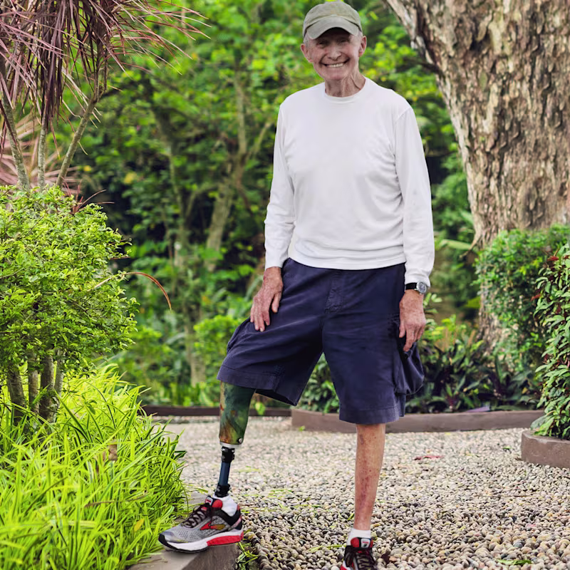 An elderly man posing in his Kintrol prosthetic foot