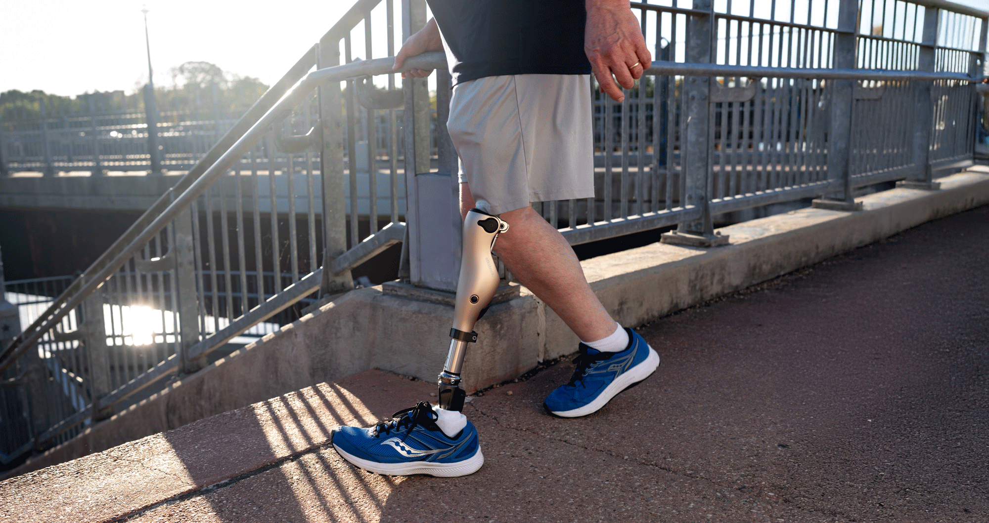 A close-up shot of a lower limb amputee walking towards a set of stairs in their Kenevo prosthetic leg