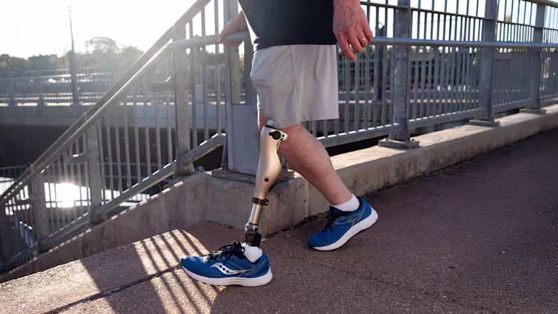 A close-up shot of a lower limb amputee walking towards a set of stairs in their Kenevo prosthetic leg