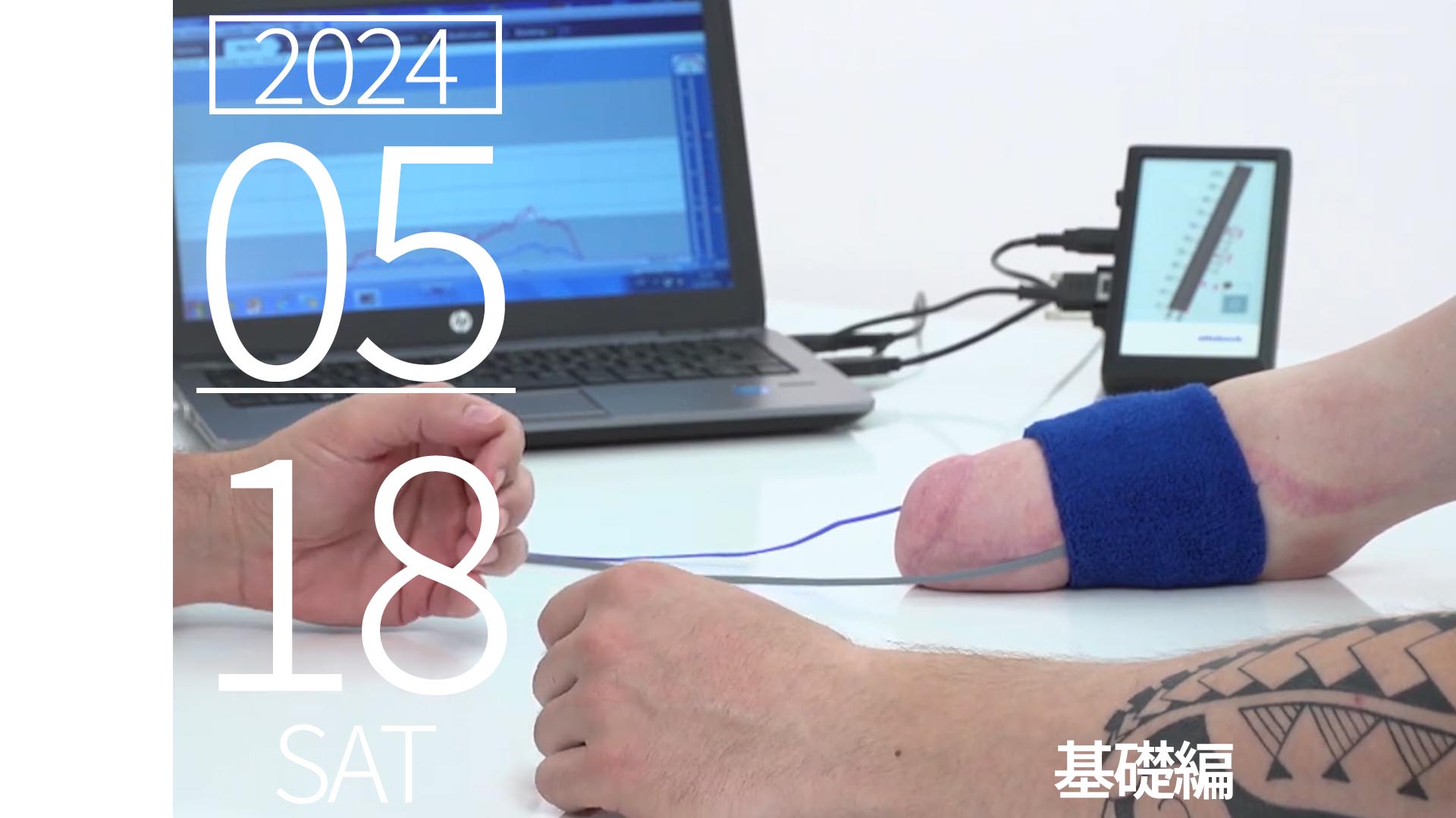 筋電義手セミナー 電極の取り方