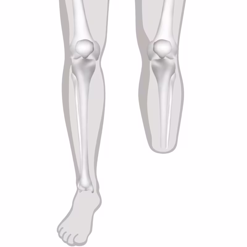 FirstSpiritExport,OBISCM-1557,web_site,medicalcare,prostheses___faqs