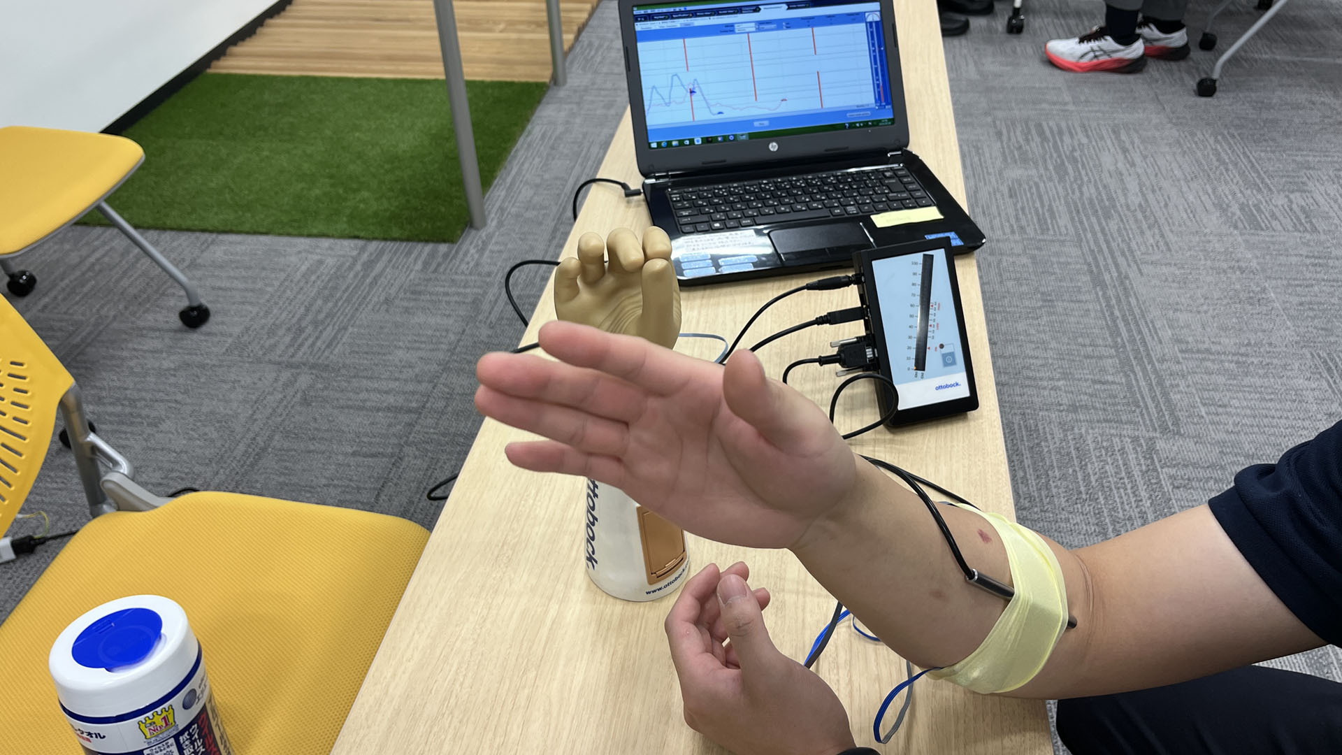 筋電義手セミナー 基礎編 実技セミナー ハンズオン 電極の取り方