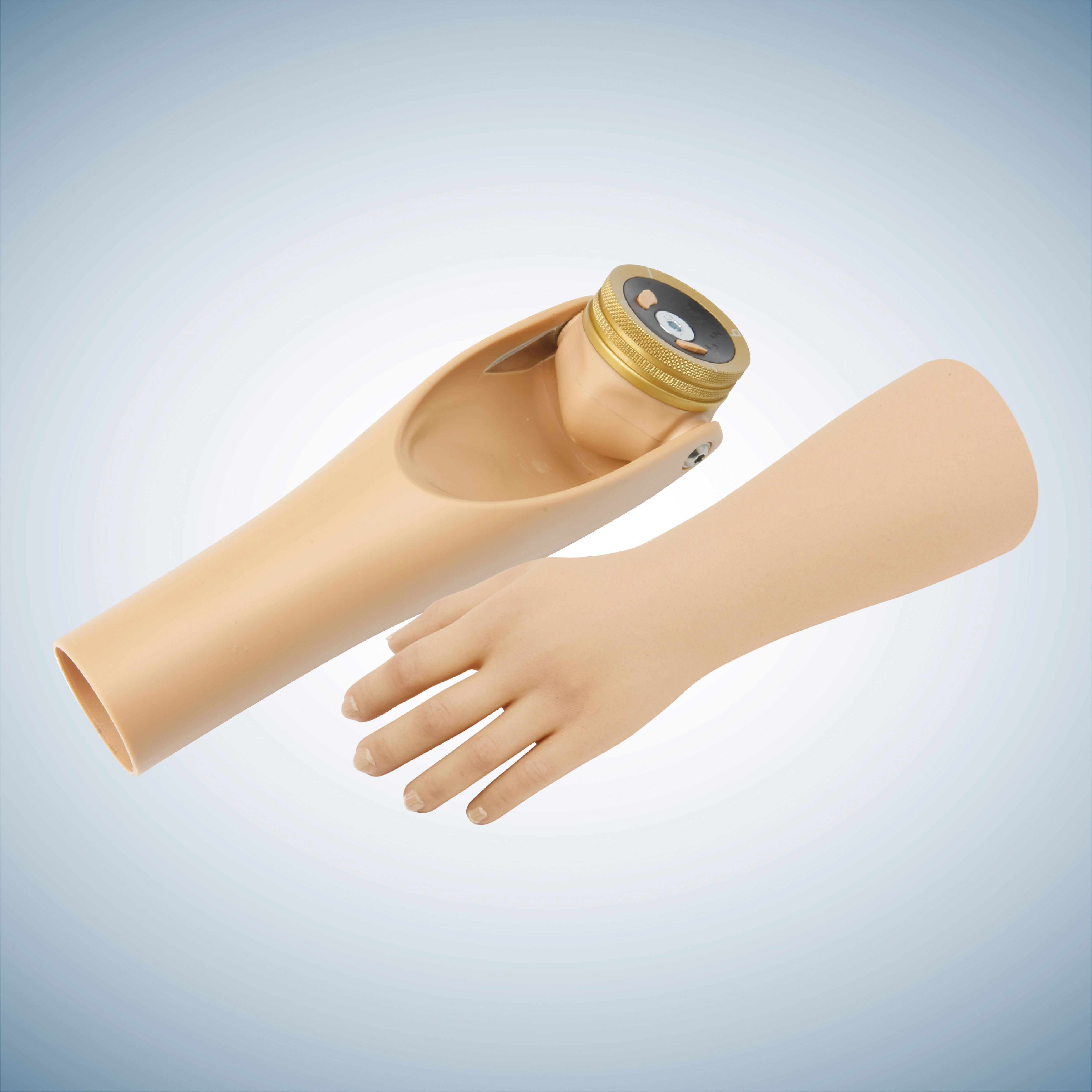 Above-elbow child prosthesis: Ottobock MovolinoArm Friction and Electric Hand 2000.