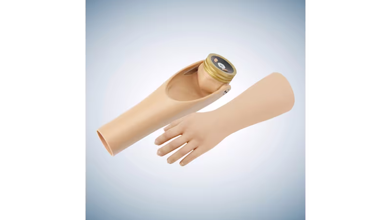 Above-elbow child prosthesis: Ottobock MovolinoArm Friction and Electric Hand 2000.
