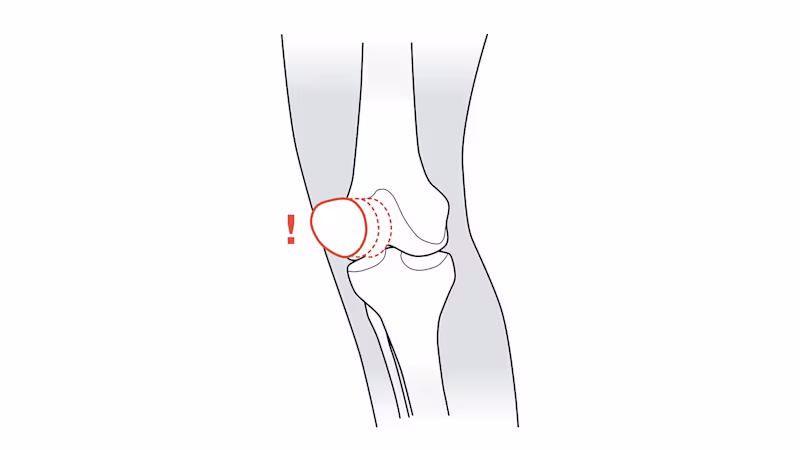 FirstSpiritExport,OBISCM-1557,web_site,orthotics_2,knee_pain
