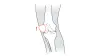 FirstSpiritExport,OBISCM-1557,web_site,orthotics_2,knee_pain
