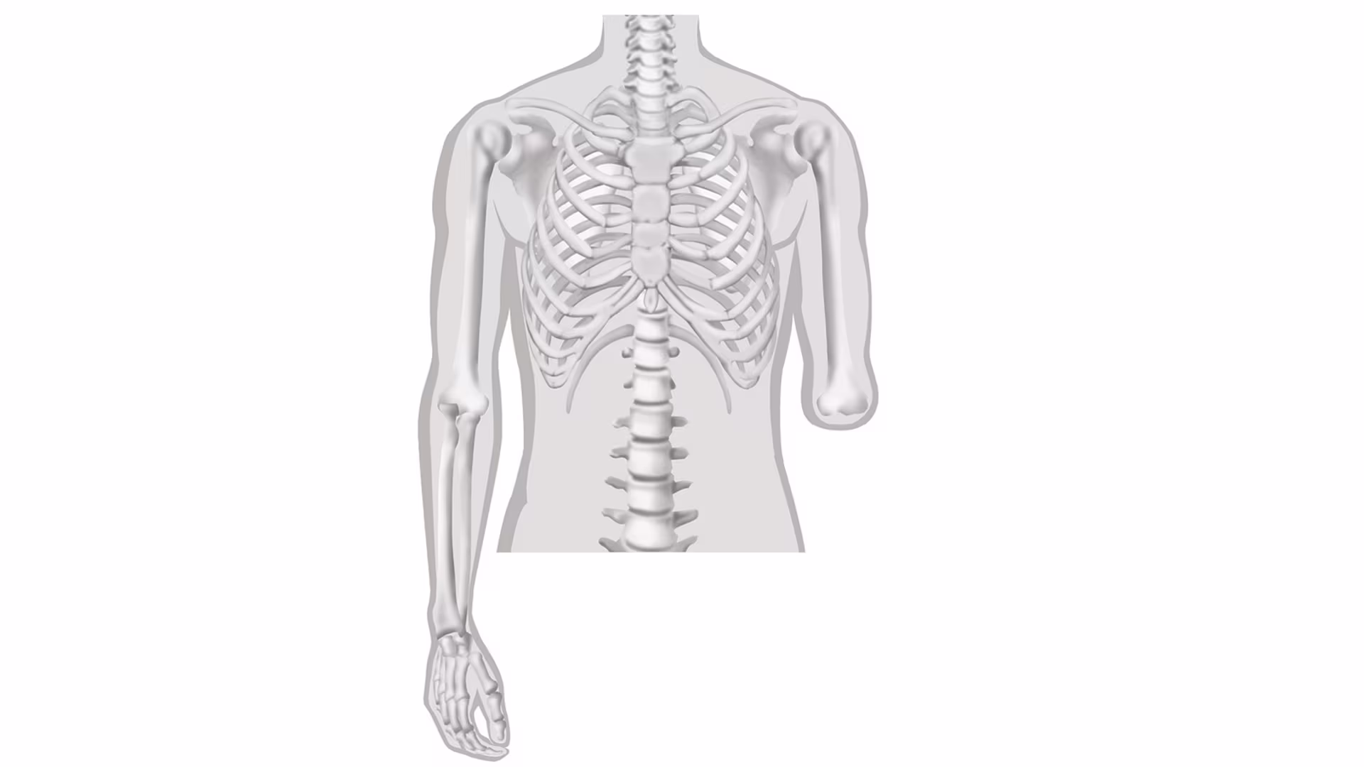 義手 切断レベル 前腕義手/上腕義手 肘関節離断