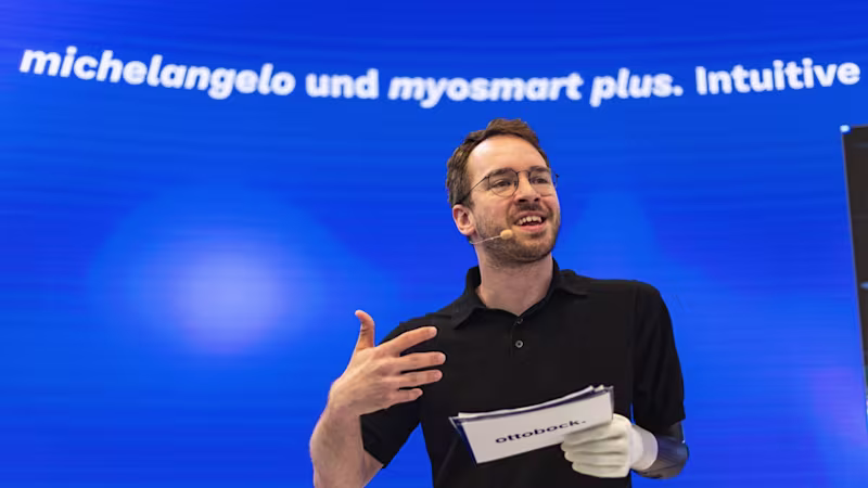 Andreas Onea presenting the Michelangelo hand and MyoSmart Plus prosthetic control system at an Ottobock event.