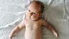 Baby with muscular torticollis lying on its back