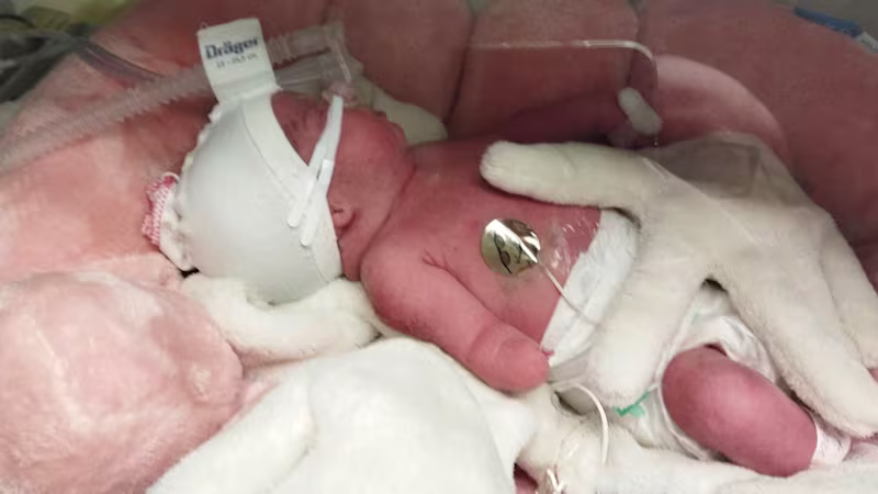 Zorka-2400x1344-3-amputace-hk-u-deti