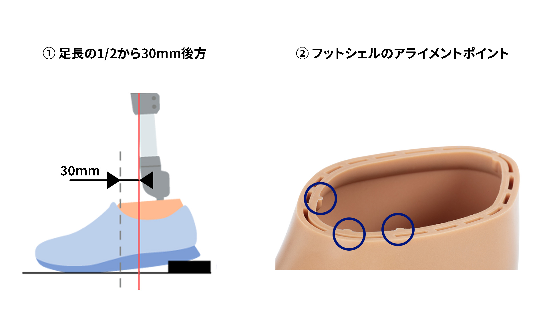 foot alignment point_JA-JP
