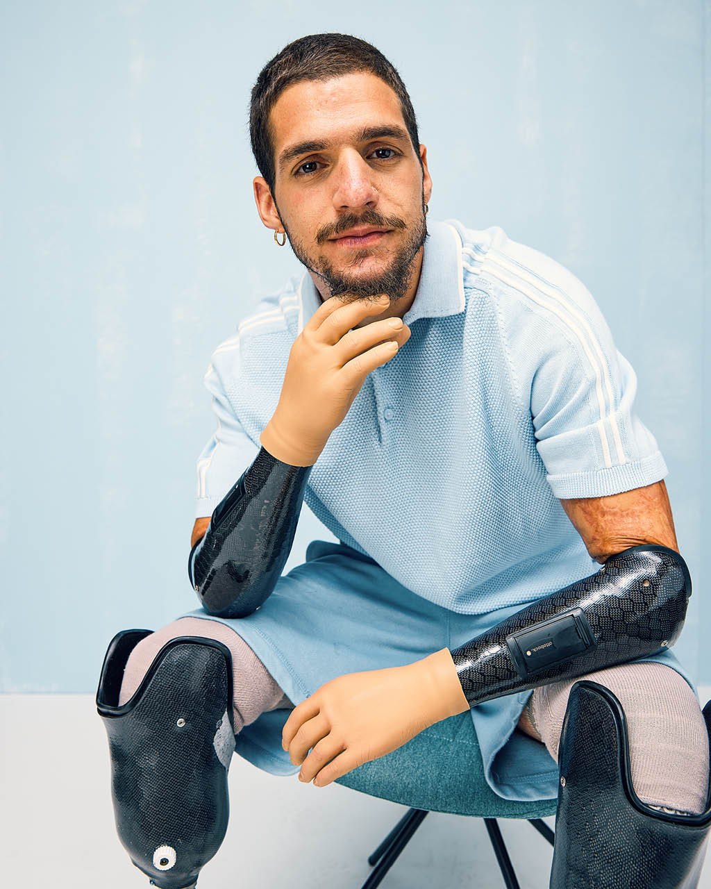 Ein Armprothesenträger sitzt auf einem Stuhl und sieht nachdenklich aus. Er trägt die VariPlus Speed Hand von Ottobock