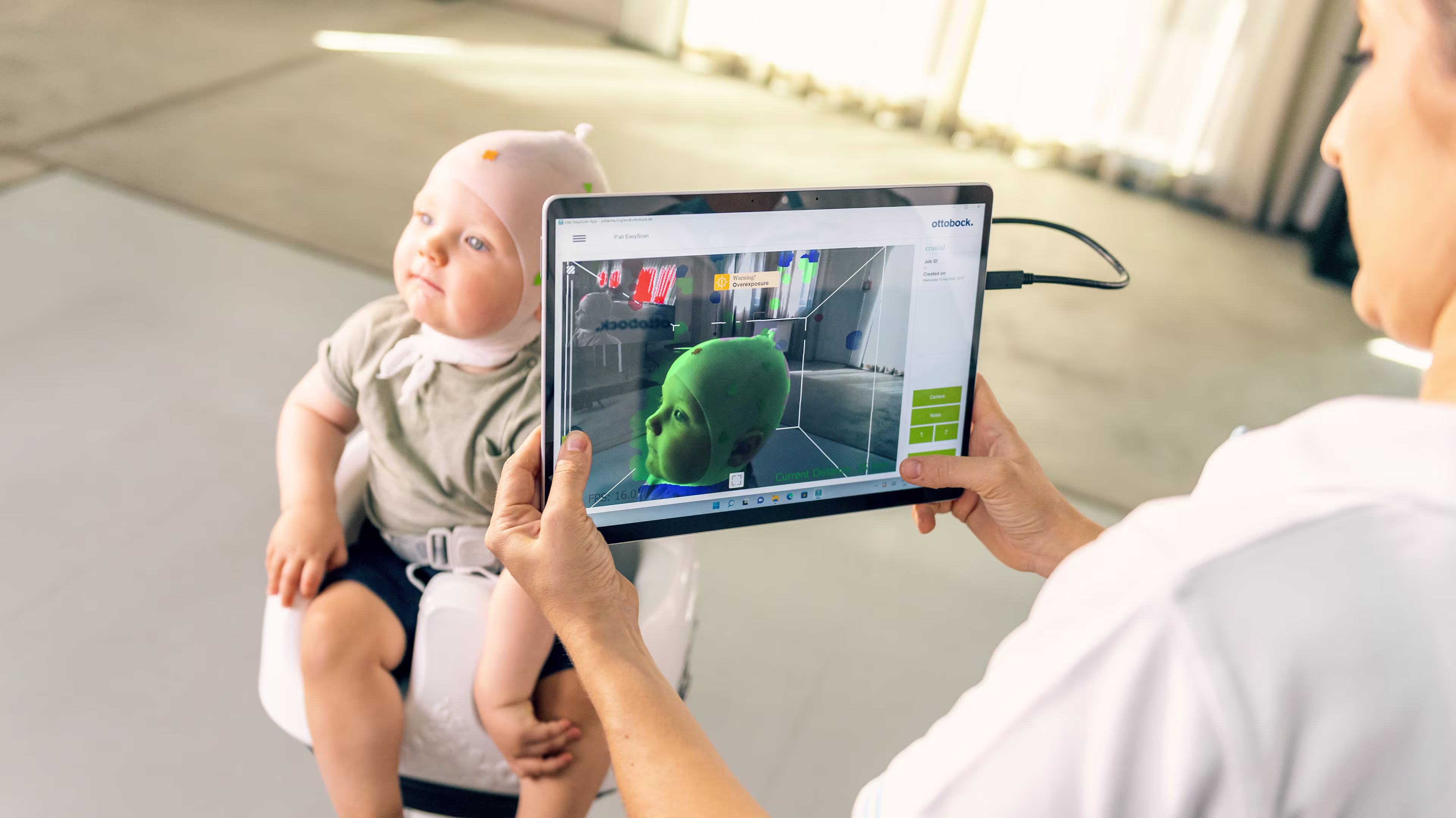 Baby getting scanned with tablet by healthcare professional for Ottobock’s cranial orthosis MyCRO Band.