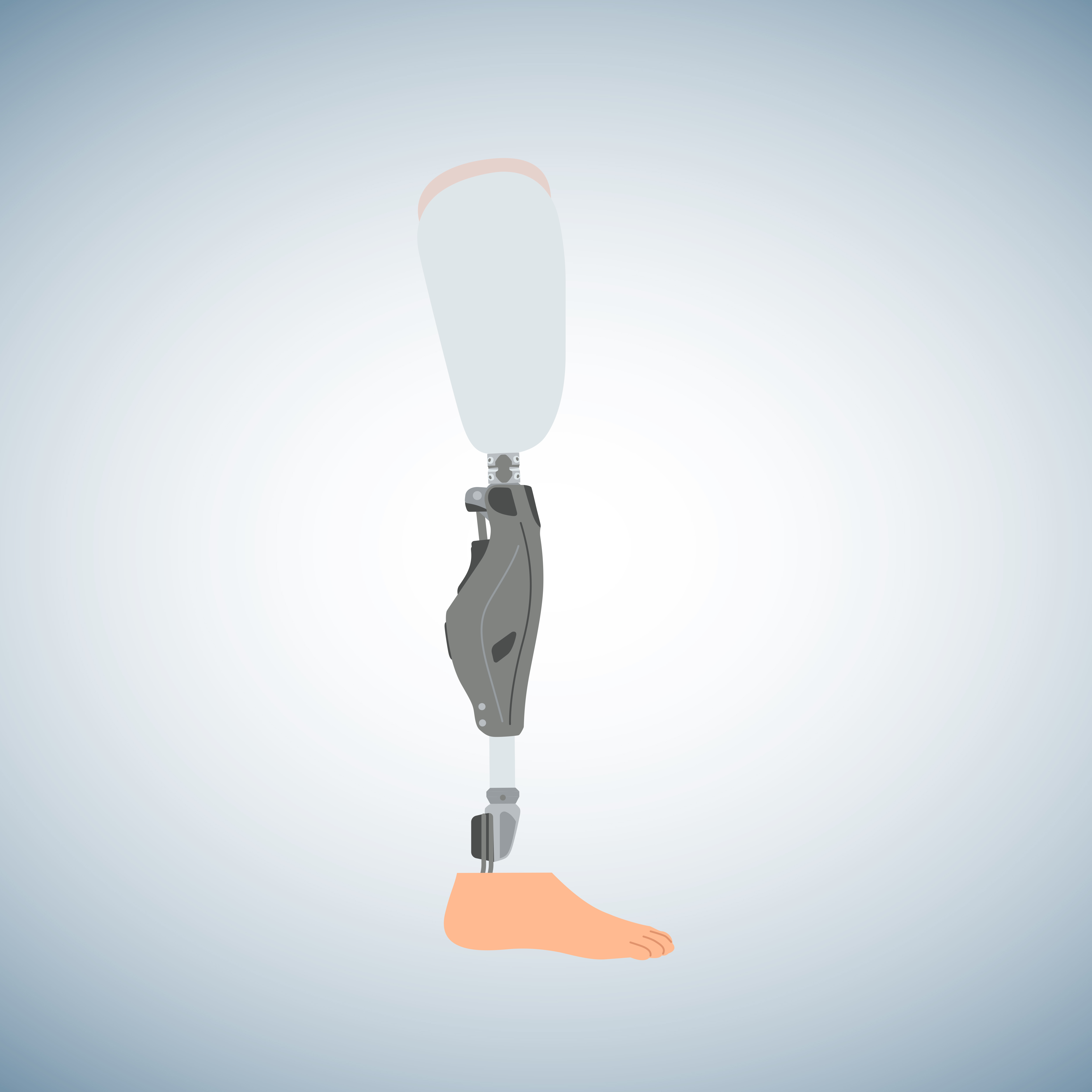 Schematic illustration of an above-knee prosthesis.