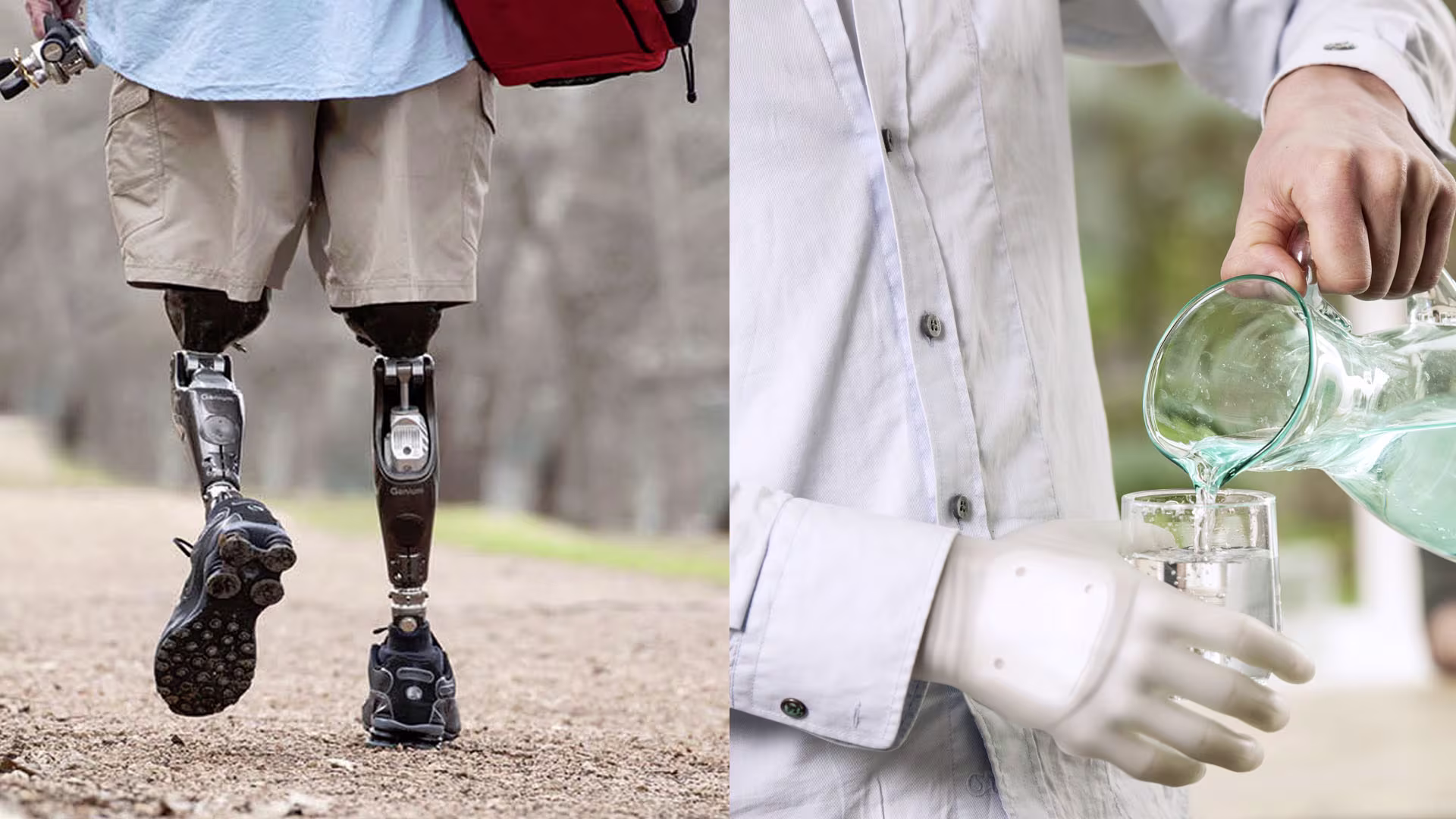 下肢の切断・上肢の切断