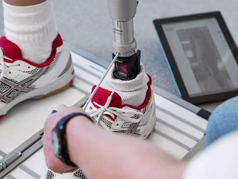 はじめての義足/義手 アライメント調整/リハビリテーション/歩行トレーニング