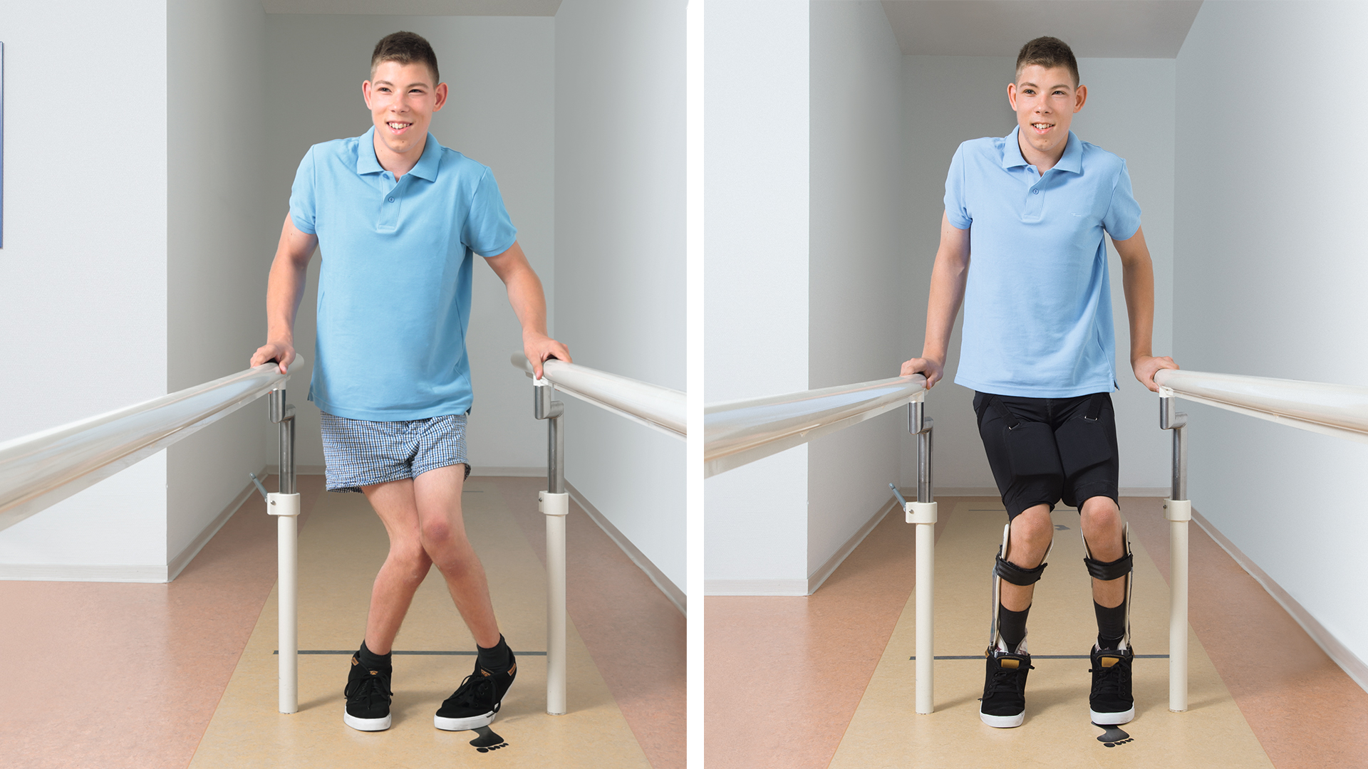 股関節　装具　内転制限　はさみ足　コサ アクティブ/コサ ジュニア