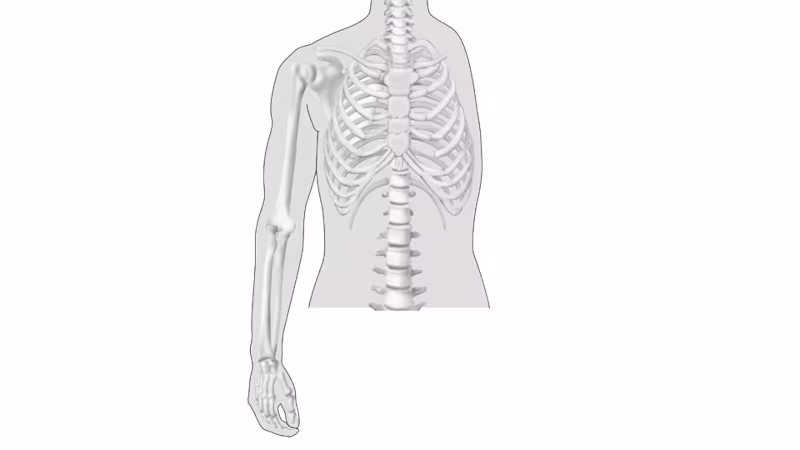 amputation level upper limb drawing 16 9 content-8
