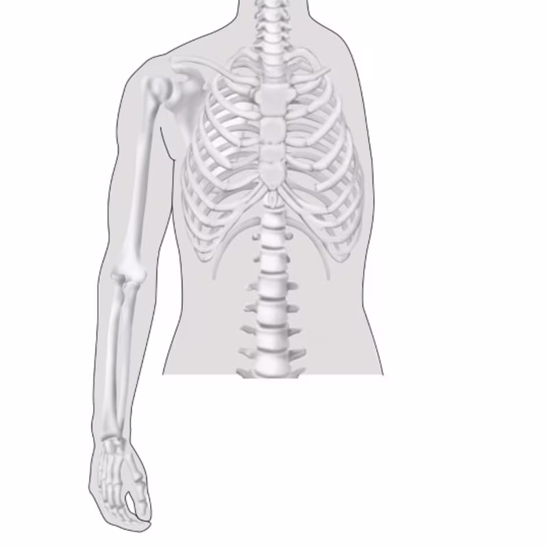 amputation level upper limb drawing 16 9 content-8