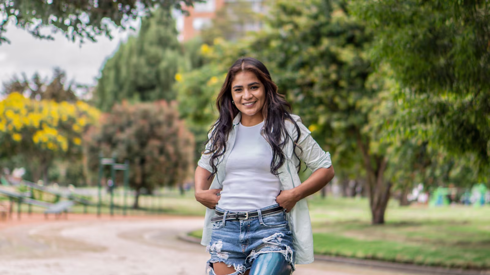 An amputee is accompanied by O&P professionals as he trials a leg prothesis
