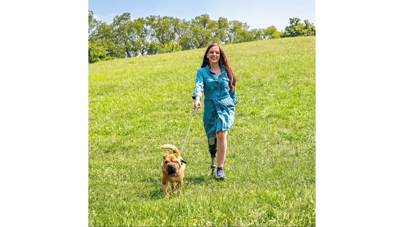 A lower limb prosthesis user walks her dog on a field