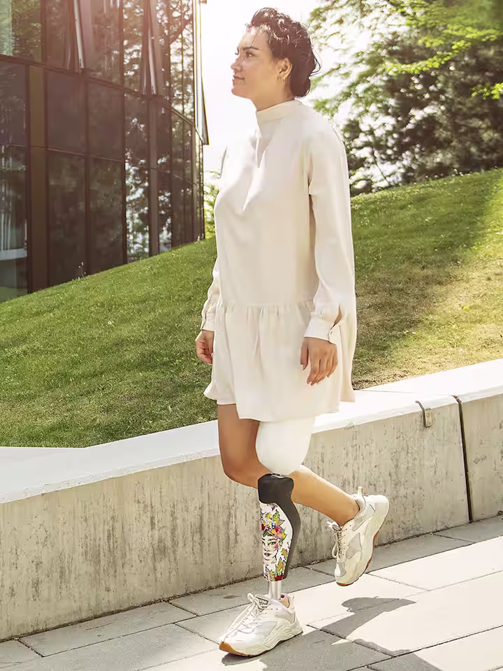 Rebecca posiert mit ihrer individualisierten C-Leg-Blende für ein Foto