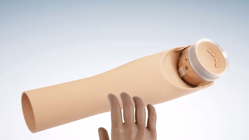 Prosthetic hands and arms for casual users - Casual combinations for below-elbow limb differences - ErgoArm and mHand (AU)