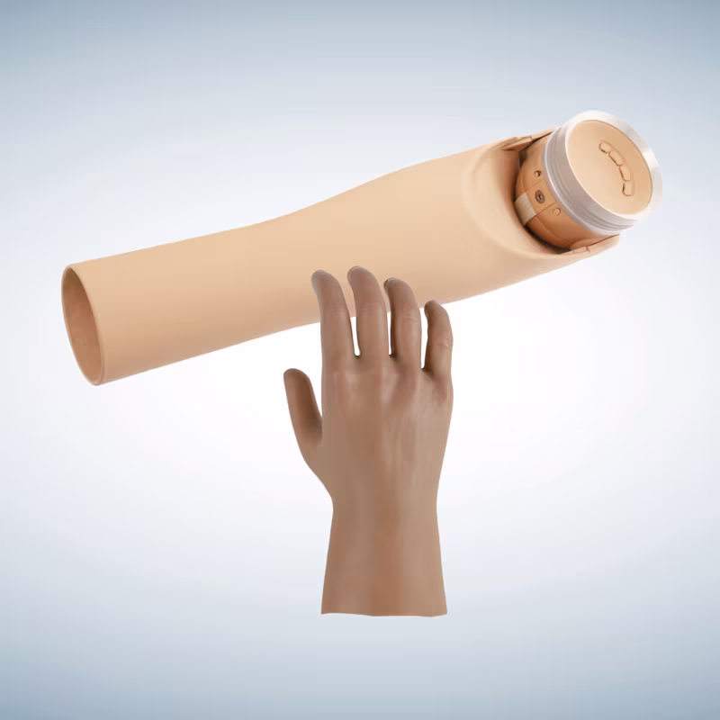 Prosthetic hands and arms for casual users - Casual combinations for below-elbow limb differences - ErgoArm and mHand (AU)