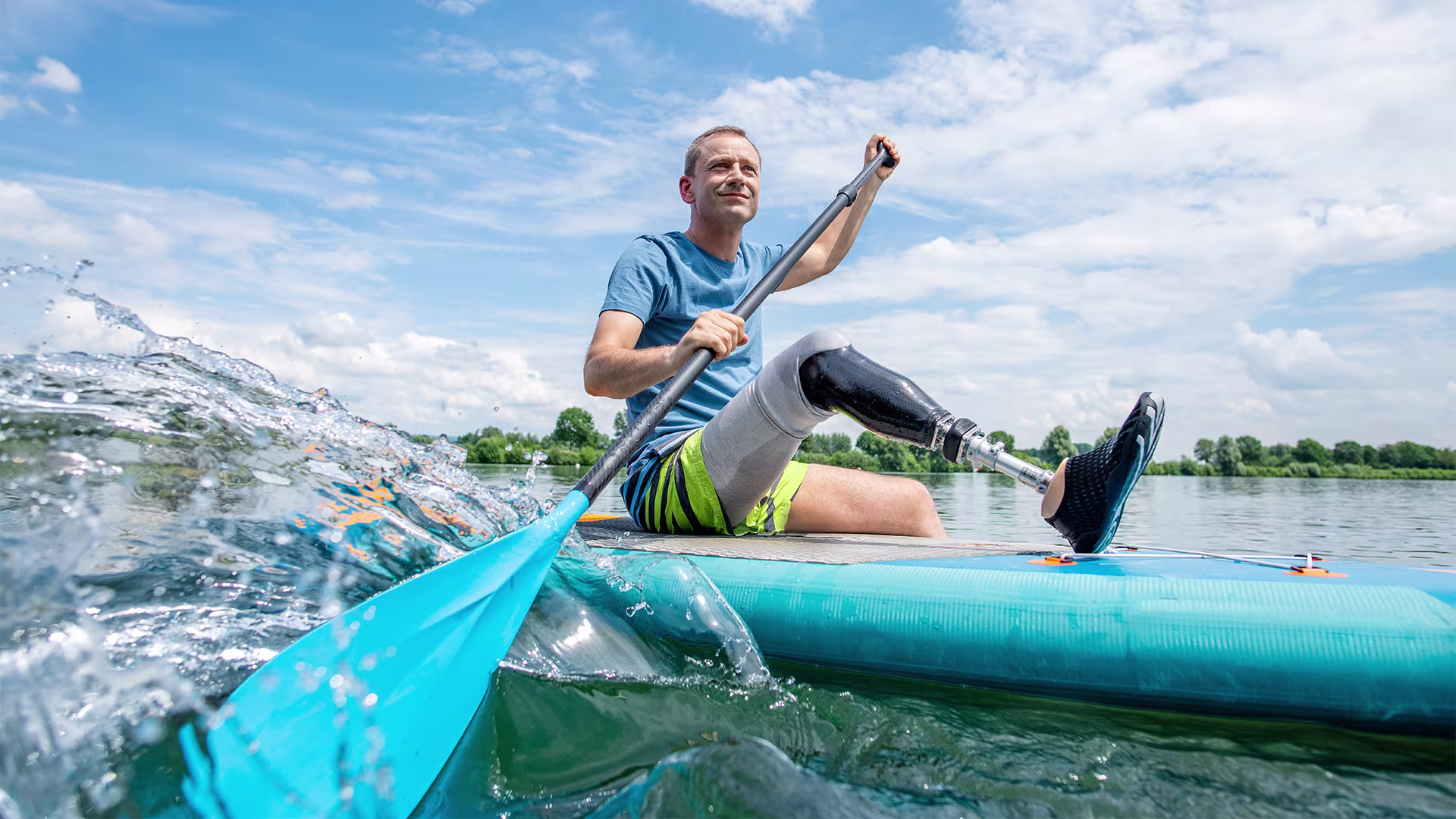 Ein Mann mit einer Beinprothese sitzt auf einem Surfboard und paddelt über einen See.